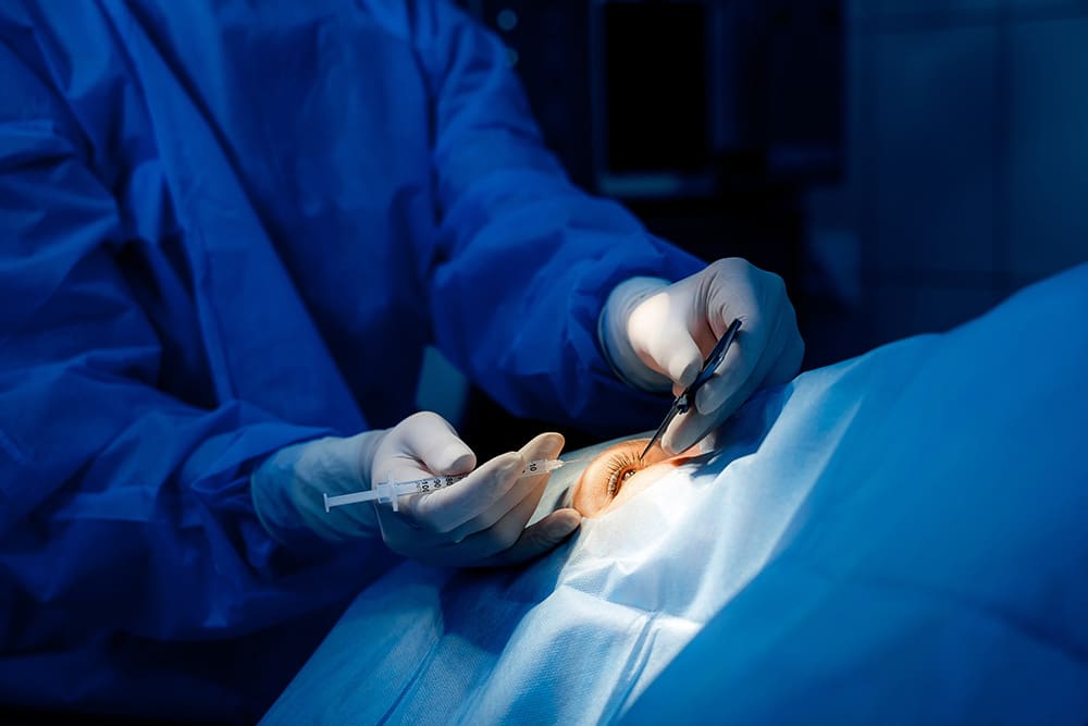 10 Factors that Affect the Cost of Cornea transplant Surgery 